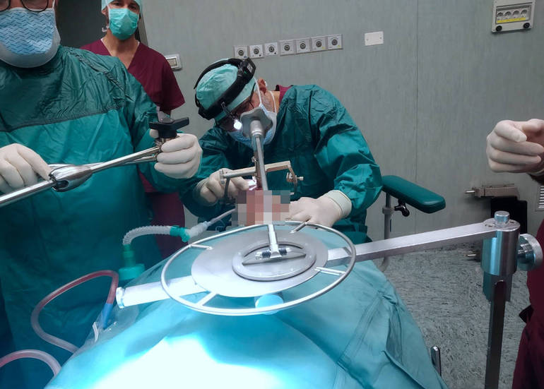 Il dottor Abramo durante l’intervento di chirurgia con tecnica ultrasonica  